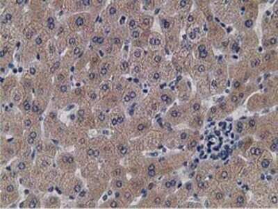 Immunohistochemistry: KCTD14 Antibody (OTI1D11) - Azide and BSA Free [NBP2-72173]