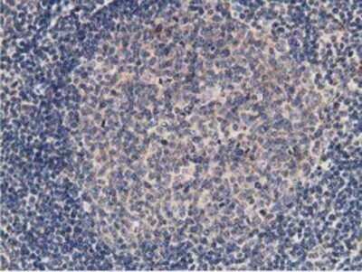 Immunohistochemistry: KCTD14 Antibody (OTI1D11) - Azide and BSA Free [NBP2-72173]