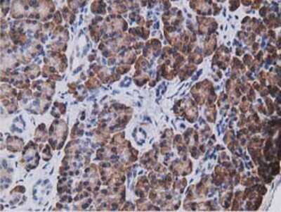 Immunohistochemistry: KCTD14 Antibody (OTI1D11) - Azide and BSA Free [NBP2-72173]