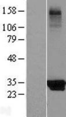 Western Blot: KCTD14 Overexpression Lysate [NBL1-12211]