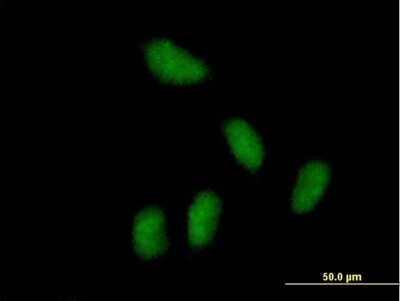 Immunocytochemistry/ Immunofluorescence: KCTD15 Antibody [H00079047-B01P]