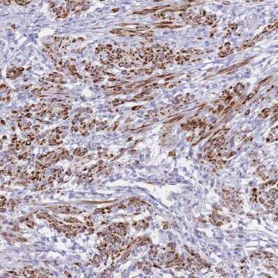 Immunohistochemistry-Paraffin: KCTD15 Antibody [NBP2-14148]