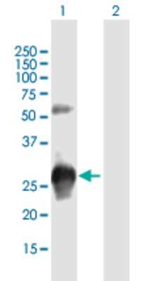 Western Blot: KCTD15 Antibody [H00079047-B01P]