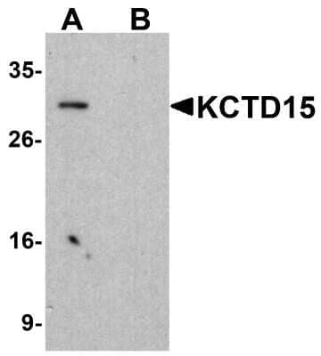 Western Blot: KCTD15 AntibodyBSA Free [NBP1-77007]