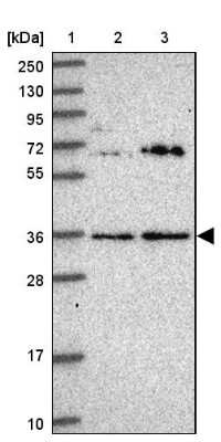 Western Blot: KCTD15 Antibody [NBP2-14148]