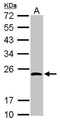 Western Blot: KCTD15 Antibody [NBP2-17030]