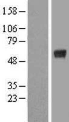 Western Blot: KCTD15 Overexpression Lysate [NBP2-06343]