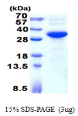 SDS-PAGE: Recombinant Human KCTD15 His Protein [NBP2-23353]