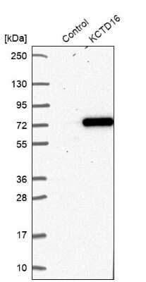 Western Blot: KCTD16 Antibody [NBP2-30470]