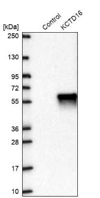 Western Blot: KCTD16 Antibody [NBP2-30652]