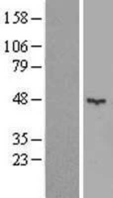 Western Blot: KCTD16 Overexpression Lysate [NBL1-12213]