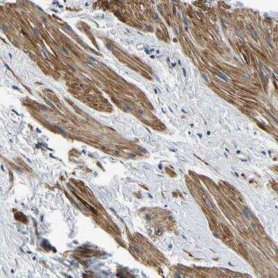 Immunohistochemistry-Paraffin: KCTD17 Antibody [NBP1-82306]