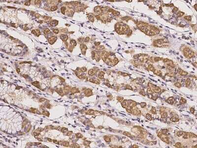 Immunohistochemistry-Paraffin: KCTD17 Antibody [NBP2-98018]