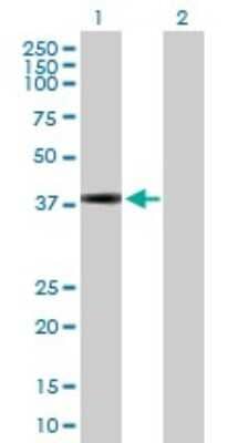 Western Blot: KCTD17 Antibody [H00079734-B01P]