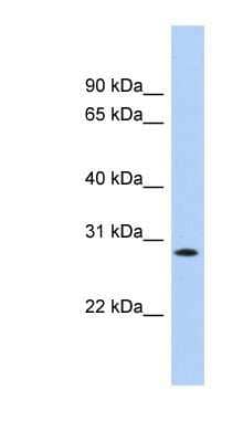 Western Blot: KCTD17 Antibody [NBP1-80085]