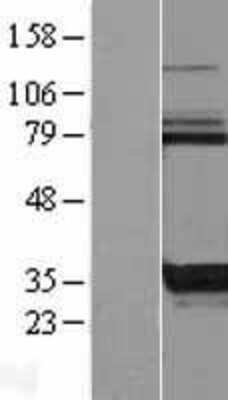 Western Blot: KCTD17 Overexpression Lysate [NBL1-12214]