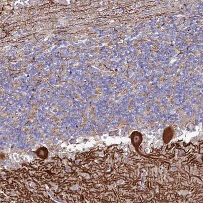 Immunohistochemistry-Paraffin: KCTD18 Antibody [NBP1-92044]