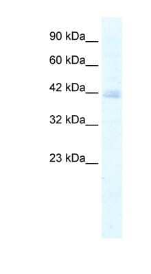 Western Blot: KCTD18 Antibody [NBP1-80093]