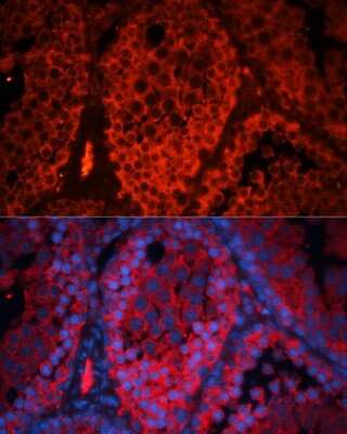 Immunohistochemistry: KCTD19 Antibody - Azide and BSA Free [NBP3-04653]