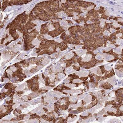 Immunohistochemistry-Paraffin: KCTD19 Antibody [NBP2-14149]