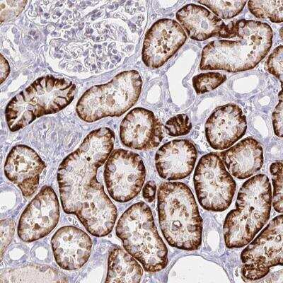 Immunohistochemistry-Paraffin: KCTD19 Antibody [NBP2-33682]