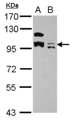 Western Blot: KCTD19 Antibody [NBP2-17031]