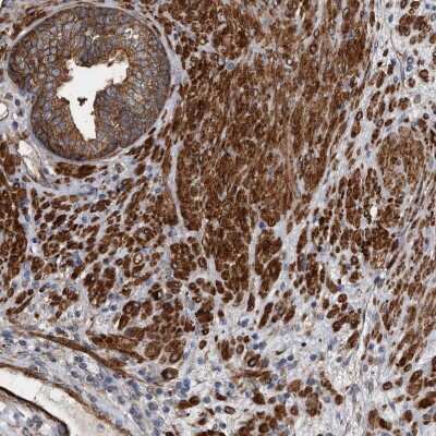 Immunohistochemistry-Paraffin: KCTD20 Antibody [NBP1-86738]