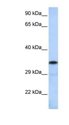 Western Blot: KCTD4 Antibody [NBP1-80106]