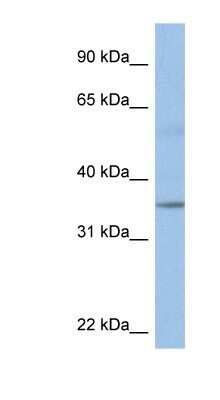 Western Blot: KCTD4 Antibody [NBP1-80208]