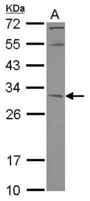 Western Blot: KCTD4 Antibody [NBP2-17033]