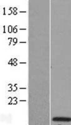 Western Blot: KCTD4 Overexpression Lysate [NBP2-04735]