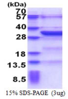 SDS-PAGE: Recombinant Human KCTD4 His Protein [NBP2-23354]