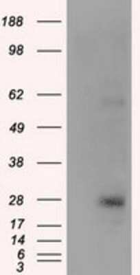 Western Blot: KCTD5 Antibody (OTI3C8) [NBP2-02414]