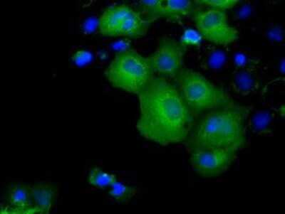 Immunocytochemistry/ Immunofluorescence: KCTD5 Antibody (OTI3C8) - Azide and BSA Free [NBP2-71955]