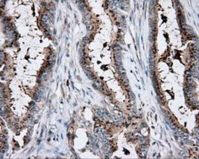 Immunohistochemistry: KCTD5 Antibody (OTI3C8) - Azide and BSA Free [NBP2-71955]