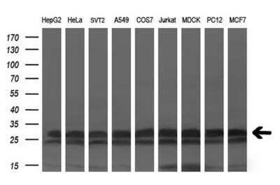 Western Blot: KCTD5 Antibody (OTI3C8)Azide and BSA Free [NBP2-71955]