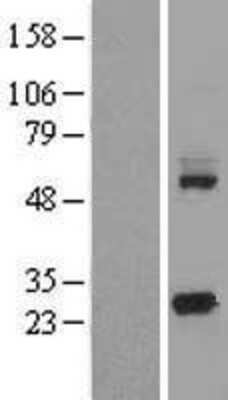 Western Blot: KCTD5 Overexpression Lysate [NBL1-12216]