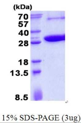 SDS-PAGE: Recombinant Human KCTD5 His Protein [NBP2-23355]