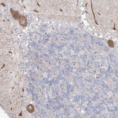 Immunohistochemistry-Paraffin: KCTD6 Antibody [NBP1-81562]