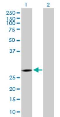 Western Blot: KCTD6 Antibody [H00200845-B01P]