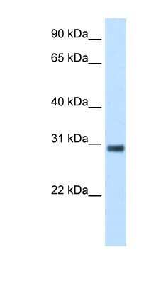 Western Blot: KCTD6 Antibody [NBP1-80095]