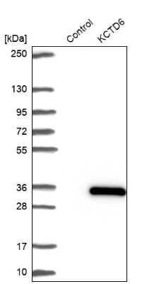 Western Blot: KCTD6 Antibody [NBP1-81562]