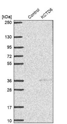 Western Blot: KCTD6 Antibody [NBP2-38281]