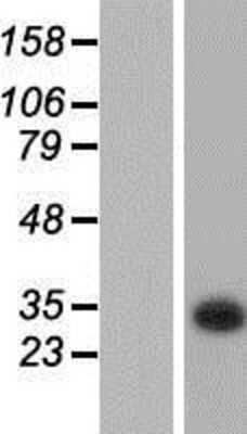 Western Blot: KCTD6 Overexpression Lysate [NBP2-05253]