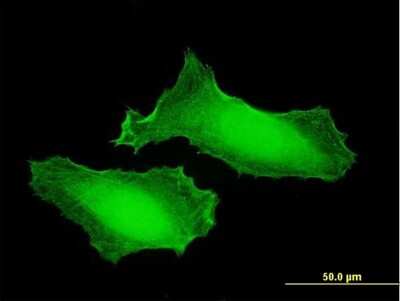 Immunocytochemistry/ Immunofluorescence: KCTD7 Antibody [H00154881-B01P]