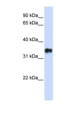 Western Blot: KCTD7 Antibody [NBP1-80094]