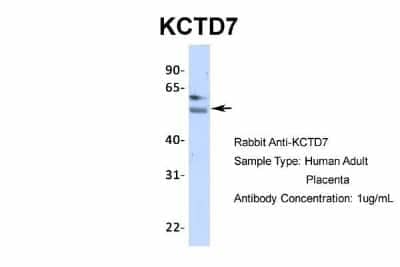 Western Blot: KCTD7 Antibody [NBP1-80094]