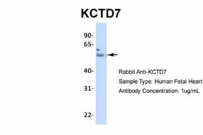 Western Blot: KCTD7 Antibody [NBP1-80094]