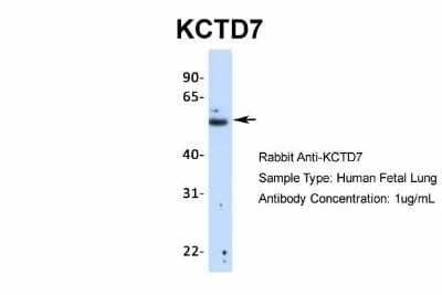 Western Blot: KCTD7 Antibody [NBP1-80094]