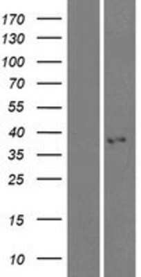 Western Blot: KCTD7 Overexpression Lysate [NBP2-05284]